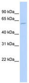 Fatty Acid Desaturase 1 antibody, TA346475, Origene, Western Blot image 