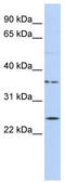 IQ Motif Containing F1 antibody, TA338836, Origene, Western Blot image 