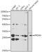 Peroxiredoxin 4 antibody, GTX55743, GeneTex, Western Blot image 