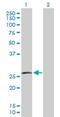 Nuclear Receptor Coactivator 3 antibody, H00005881-D01P, Novus Biologicals, Western Blot image 