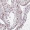 Zinc Finger Protein 689 antibody, NBP2-33706, Novus Biologicals, Immunohistochemistry paraffin image 