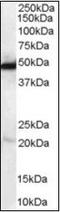 N-Myc Downstream Regulated 1 antibody, orb89285, Biorbyt, Western Blot image 