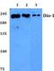 Death Inducer-Obliterator 1 antibody, PA5-36337, Invitrogen Antibodies, Western Blot image 