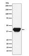 Spi-1 Proto-Oncogene antibody, M01116, Boster Biological Technology, Western Blot image 