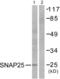 Synaptosome Associated Protein 25 antibody, LS-B8391, Lifespan Biosciences, Western Blot image 