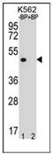 Olfactory Receptor Family 8 Subfamily K Member 3 (Gene/Pseudogene) antibody, AP53110PU-N, Origene, Western Blot image 