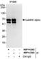 Calcium/Calmodulin Dependent Protein Kinase Kinase 1 antibody, NBP1-42682, Novus Biologicals, Immunoprecipitation image 