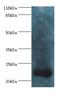 Recoverin antibody, LS-C370231, Lifespan Biosciences, Western Blot image 