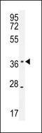 Kelch Domain Containing 1 antibody, 55-467, ProSci, Western Blot image 