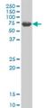 G Protein-Coupled Receptor Kinase 6 antibody, H00002870-M10, Novus Biologicals, Western Blot image 