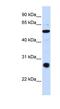 Zinc Finger Containing Ubiquitin Peptidase 1 antibody, NBP1-80397, Novus Biologicals, Western Blot image 