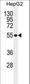 Major Facilitator Superfamily Domain Containing 10 antibody, LS-C164165, Lifespan Biosciences, Western Blot image 