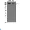 Collagen Type I Alpha 1 Chain antibody, LS-C813299, Lifespan Biosciences, Western Blot image 