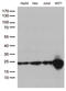 O-6-Methylguanine-DNA Methyltransferase antibody, LS-C794740, Lifespan Biosciences, Western Blot image 