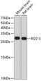 Regulator Of G Protein Signaling 13 antibody, A14493, Boster Biological Technology, Western Blot image 