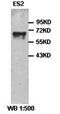 Gonadotropin Releasing Hormone Receptor antibody, orb77250, Biorbyt, Western Blot image 