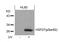 Heat Shock Protein Family B (Small) Member 1 antibody, GTX50277, GeneTex, Western Blot image 