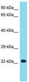 Ubiquitin Conjugating Enzyme E2 E2 antibody, TA330517, Origene, Western Blot image 