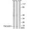 TSC22 Domain Family Member 1 antibody, A06397, Boster Biological Technology, Western Blot image 