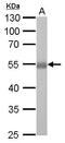 Aldehyde Dehydrogenase 1 Family Member A1 antibody, GTX123426, GeneTex, Western Blot image 