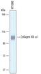 Collagen Type XIII Alpha 1 Chain antibody, AF4627, R&D Systems, Western Blot image 