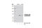 Spleen Associated Tyrosine Kinase antibody, 2711S, Cell Signaling Technology, Western Blot image 