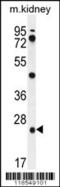 Pyroglutamyl-Peptidase I antibody, 55-987, ProSci, Western Blot image 