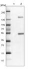 Fibroblast Growth Factor Receptor Substrate 3 antibody, PA5-56385, Invitrogen Antibodies, Western Blot image 