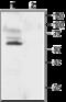 Potassium Voltage-Gated Channel Subfamily A Member 1 antibody, GTX54834, GeneTex, Western Blot image 
