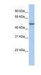 Transmembrane Protein 184A antibody, NBP1-70728, Novus Biologicals, Western Blot image 