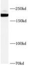 Sodium Voltage-Gated Channel Alpha Subunit 7 antibody, FNab10527, FineTest, Western Blot image 