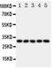 Oxidized Low Density Lipoprotein Receptor 1 antibody, PA1832, Boster Biological Technology, Western Blot image 