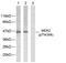 Mitogen-Activated Protein Kinase Kinase 2 antibody, PA5-38140, Invitrogen Antibodies, Western Blot image 