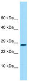 Osteoglycin antibody, TA346479, Origene, Western Blot image 