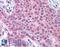 Matrix Metallopeptidase 13 antibody, LS-A1555, Lifespan Biosciences, Immunohistochemistry frozen image 