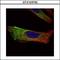 Keratin 17 antibody, GTX103765, GeneTex, Immunocytochemistry image 