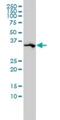 SPARC antibody, H00006678-M02, Novus Biologicals, Western Blot image 