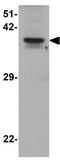 THAP Domain Containing 11 antibody, GTX31903, GeneTex, Western Blot image 