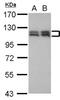 Ubiquitin Like Modifier Activating Enzyme 1 antibody, NBP2-20779, Novus Biologicals, Western Blot image 