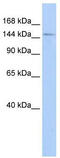 Diphosphoinositol Pentakisphosphate Kinase 2 antibody, TA333834, Origene, Western Blot image 