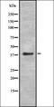 Coagulation Factor XIII A Chain antibody, orb336883, Biorbyt, Western Blot image 