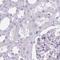 Tryptase Delta 1 antibody, HPA049554, Atlas Antibodies, Immunohistochemistry frozen image 