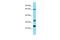 Kinesin Light Chain 4 antibody, A11236, Boster Biological Technology, Western Blot image 