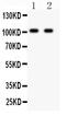 Glutamate receptor 3 antibody, PB9206, Boster Biological Technology, Western Blot image 