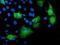 Katanin Regulatory Subunit B1 antibody, NBP2-01383, Novus Biologicals, Immunocytochemistry image 
