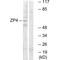 Zona Pellucida Glycoprotein 4 antibody, A07440, Boster Biological Technology, Western Blot image 