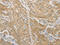 Acyl-CoA Synthetase Long Chain Family Member 4 antibody, CSB-PA283716, Cusabio, Immunohistochemistry paraffin image 