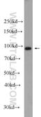 Activating Signal Cointegrator 1 Complex Subunit 2 antibody, 11529-1-AP, Proteintech Group, Western Blot image 