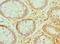 Peroxiredoxin 1 antibody, LS-C376410, Lifespan Biosciences, Immunohistochemistry paraffin image 