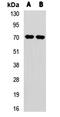 Carnitine O-Octanoyltransferase antibody, LS-C668669, Lifespan Biosciences, Western Blot image 